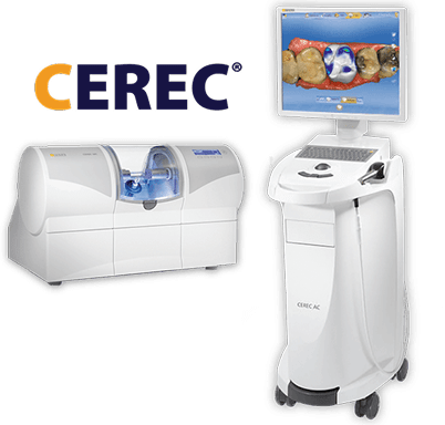 CEREC dental machine and computer workstation with monitor displaying a 3D model of teeth for digital dentistry and restoration design.